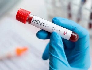 Profesörden infial yaratacak iddia: İstanbul Tıp Fakültesi’nde HIV pozitif 100 çocuk var