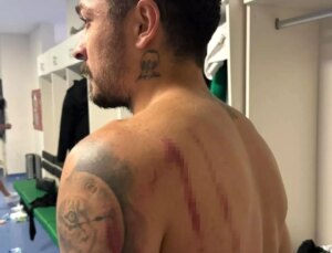 Sakaryaspor-Kocaelispor Maçında Fiziksel Saldırı Skandalı