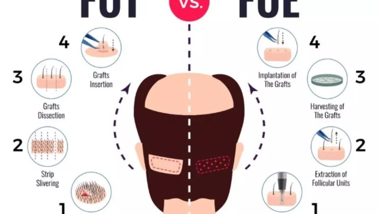 İstanbul’un En İyi 10 Saç Ekim Merkezi ve Fiyatları