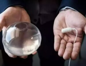 Mide balonu yasaklandı mı? Mide balonu Türkiye’de neden yasaklandı?