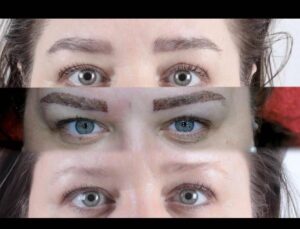 Micro Brow Implant Nedir? 