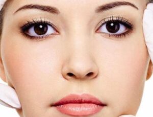 Hollywood Gülüşü Nedir?