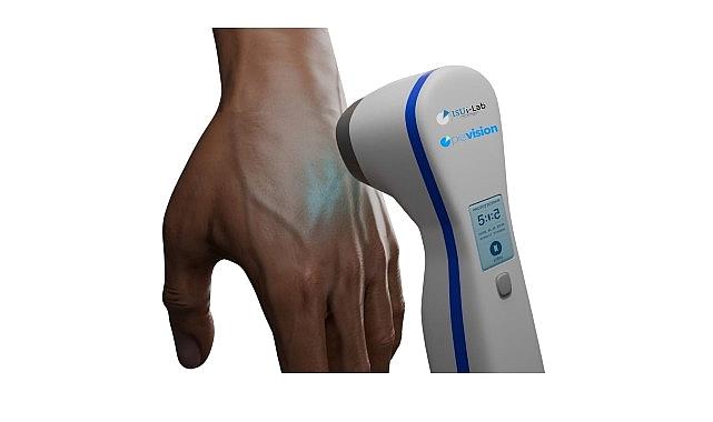 Üniversite öğrencisi babasının hastalığından yola çıkarak vitiligo tedavisi için aygıt geliştirdi