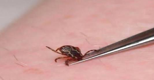 Vücudunuza kene yapışmışsa zarar vermeyin!