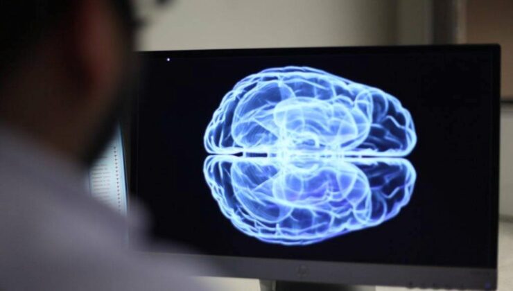 Yapay Zeka Beynin Çalışma Örüntüsünü Değiştirebilir mi ?