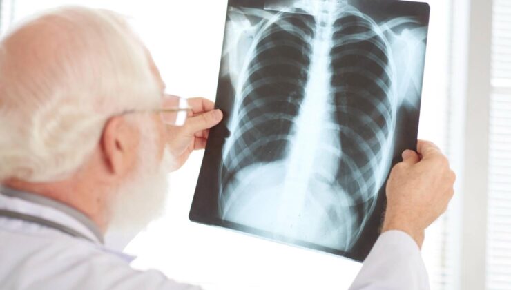 2025 Dünya Akciğer Günü 