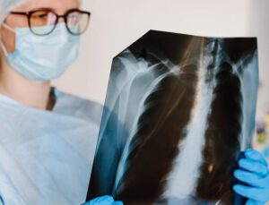 Kronik Obstrüktif Akciğer Hastalığı (KOAH) Nedir? Dünya KOAH Günü