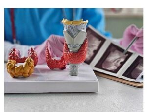 Yalancı Nodüller Gereksiz Tiroit Ameliyatlarına Yol Açabiliyor!