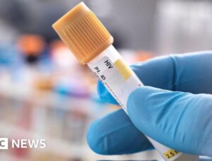 Parents accused of hiding daughter’s HIV infection and neglect