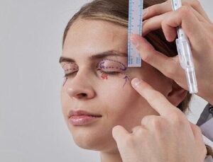 Sarkan Göz Kapakları: Estetik Bir Muhtaçlık mı, Yoksa Önemli Bir Görme Sorunu mu?