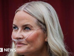 Norway’s crown princess undergoes successful lung transplant, palace says